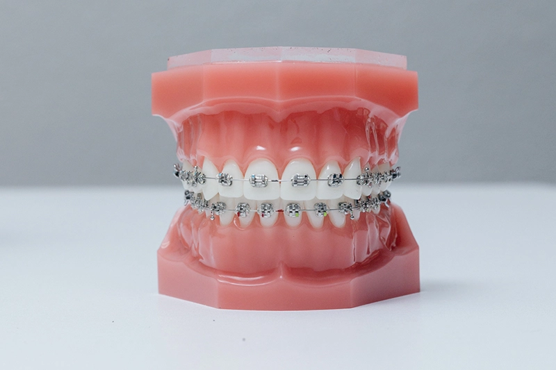 BrockwayOrthodonticsBraces