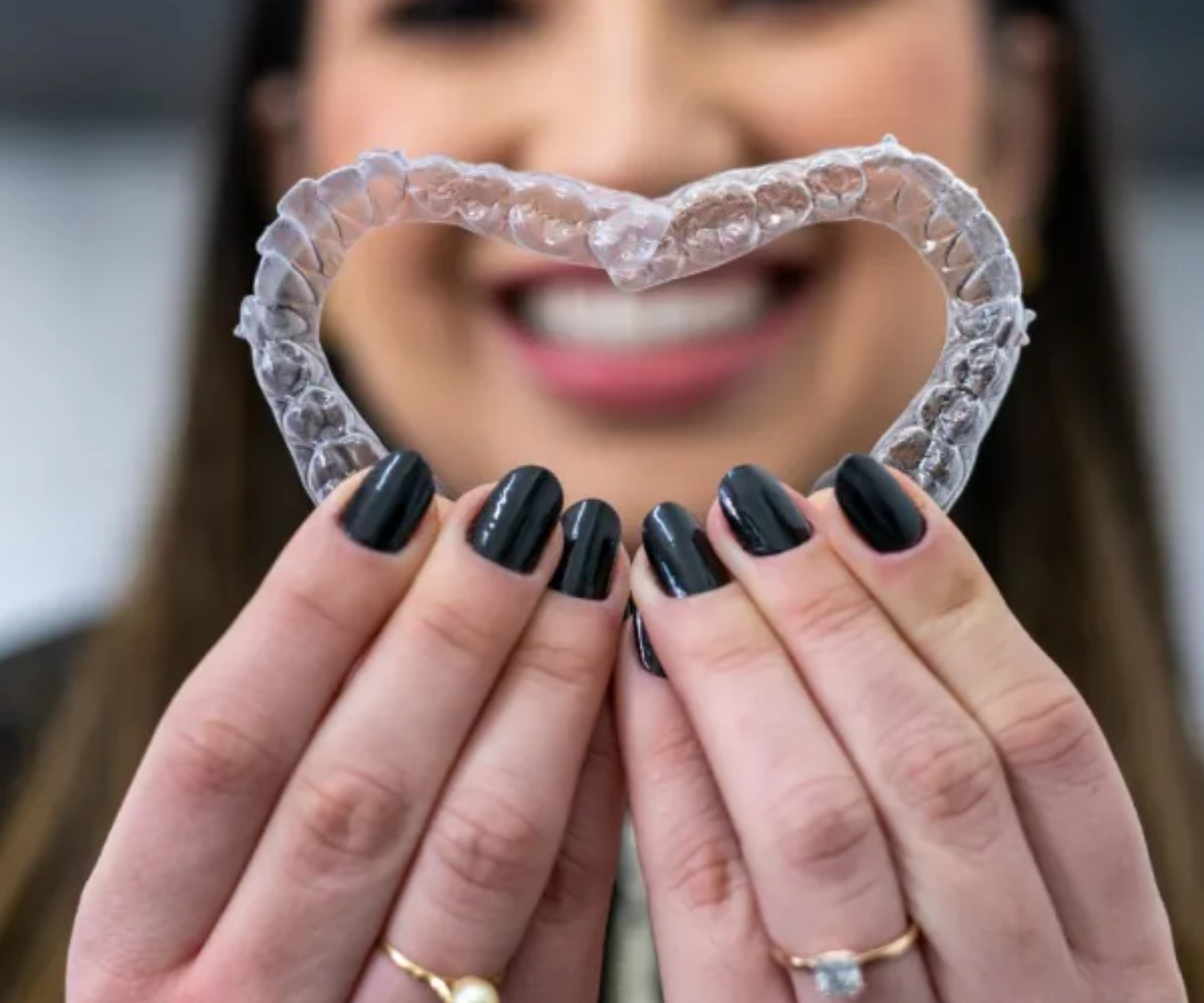 A Love for the Community young lady smiling while holding invisalign aligners in a heart shape