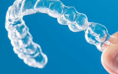 Invisalign Alternative in Clearwater: The Clear Path to Straighter Teeth