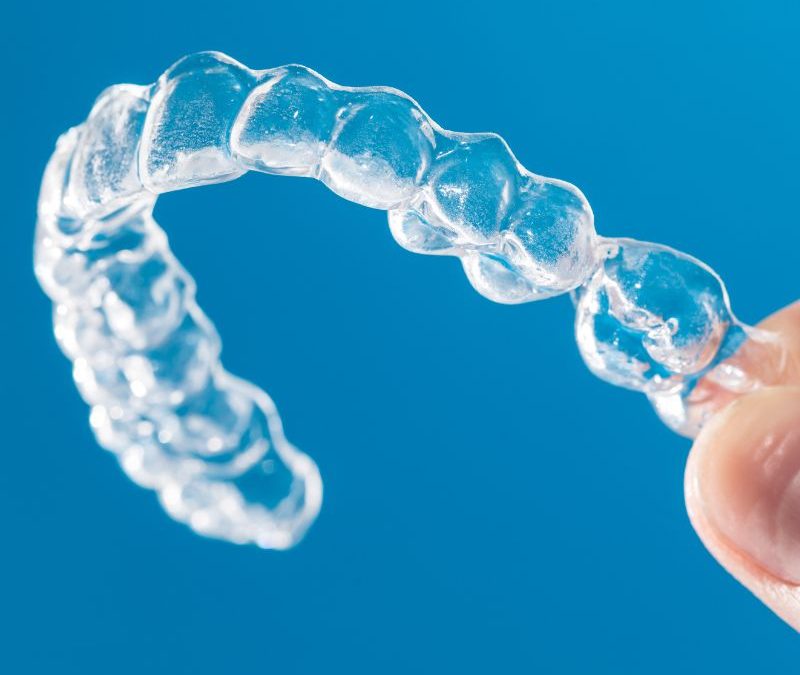 Invisalign Alternative in Clearwater: The Clear Path to Straighter Teeth