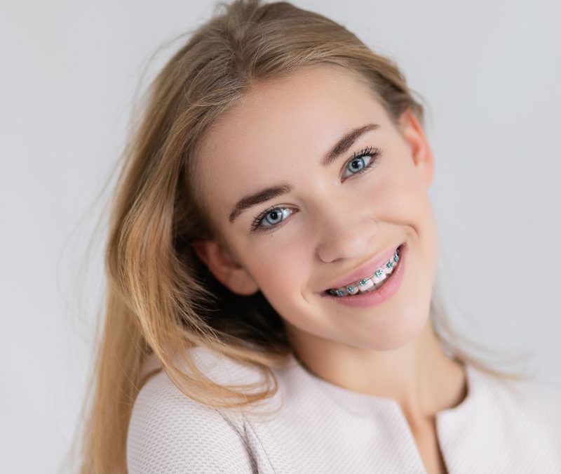 Affordable Braces in Clearwater Florida: Options for Teens, Adults, and Families