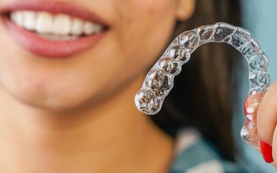 Aligner Treatment in Clearwater: Fast, Comfortable, and Nearly Invisible