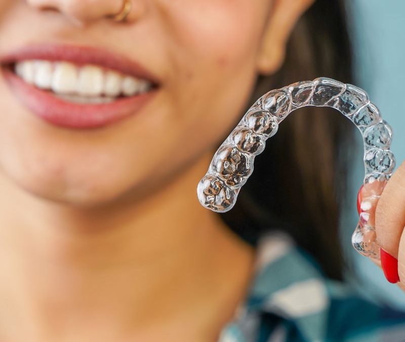 Aligner Treatment in Clearwater: Fast, Comfortable, and Nearly Invisible