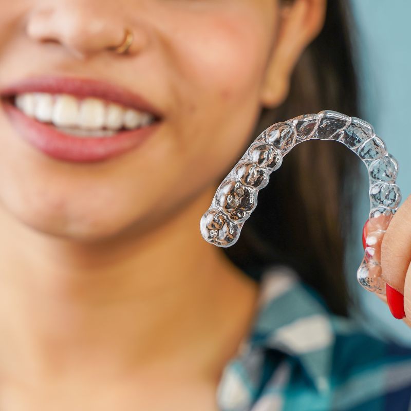 aligner treatment in Clearwater aligner treatment in Clearwater