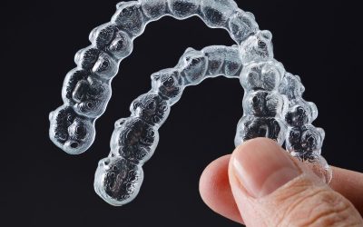 Clear Aligners in Clearwater: Affordable Options for Adults and Teens