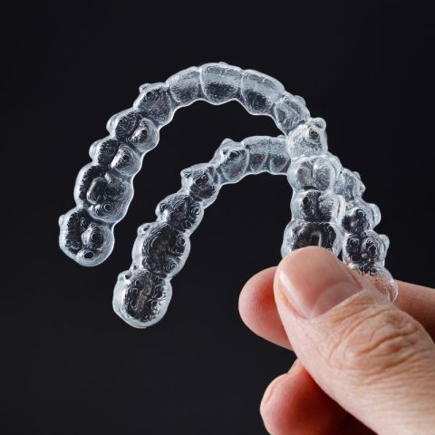 Clear Aligners in Clearwater - Brockway Orthodontics