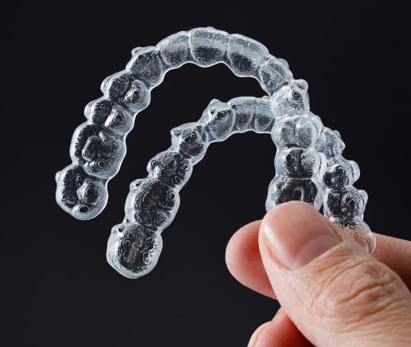 Clear Aligners in Clearwater: Affordable Options for Adults and Teens