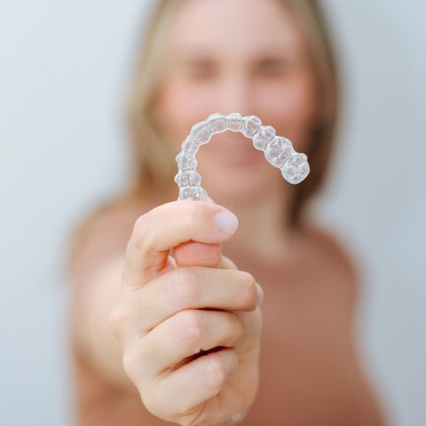 Spark Clear Aligners vs Invisalign: Which is Better for Your Lifestyle ...