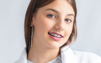 Where to Get Braces in Clearwater: Affordable Options for Every Budget