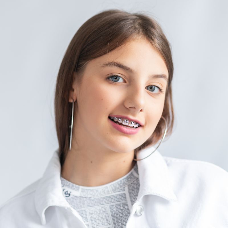 where to get braces in Clearwater where to get braces in Clearwater