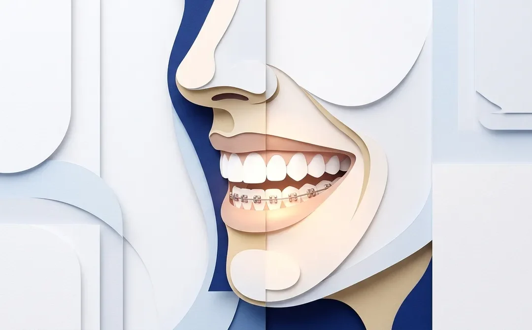 Adult Bottom Braces: What You Need to Know