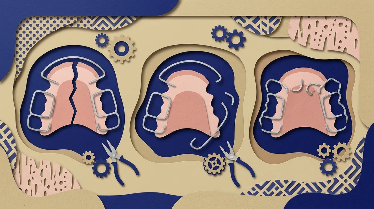 what to do if your retainer breaks