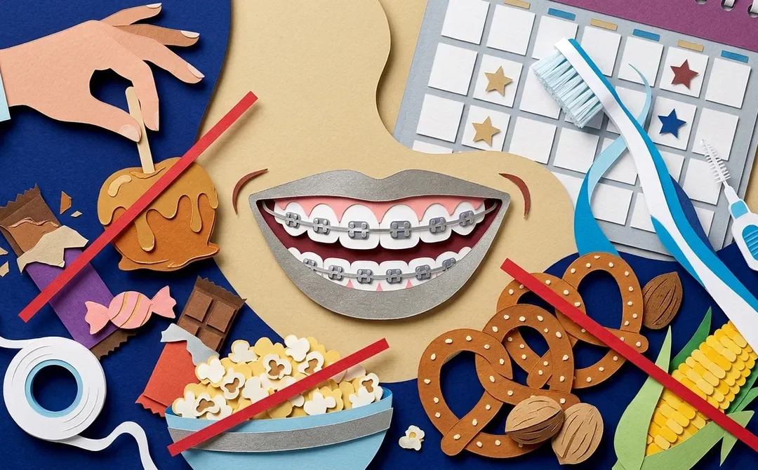 10 Metal Braces Mistakes to Avoid in Clearwater FL