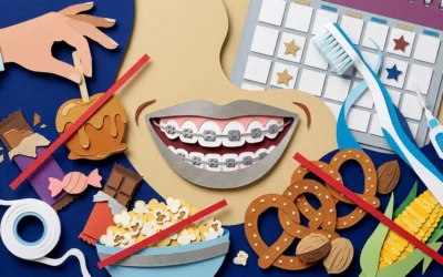 10 Metal Braces Mistakes to Avoid in Clearwater FL