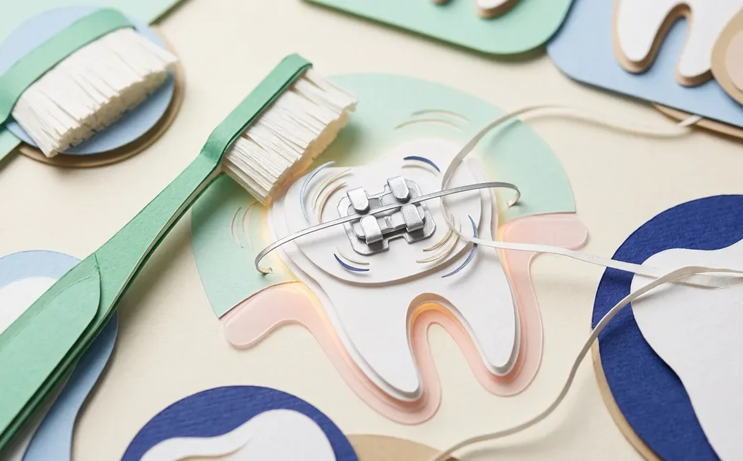 How to Brush Teeth With Braces and Keep Your Smile Healthy