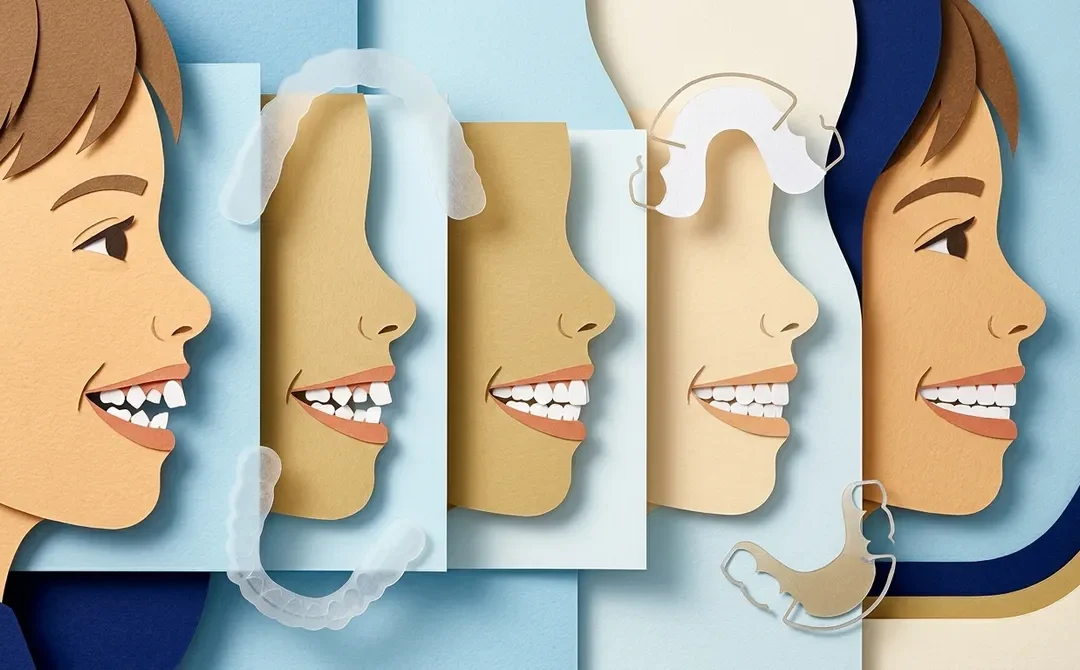 9 Crooked Teeth Fix Mistakes That Delay Your Perfect Smile