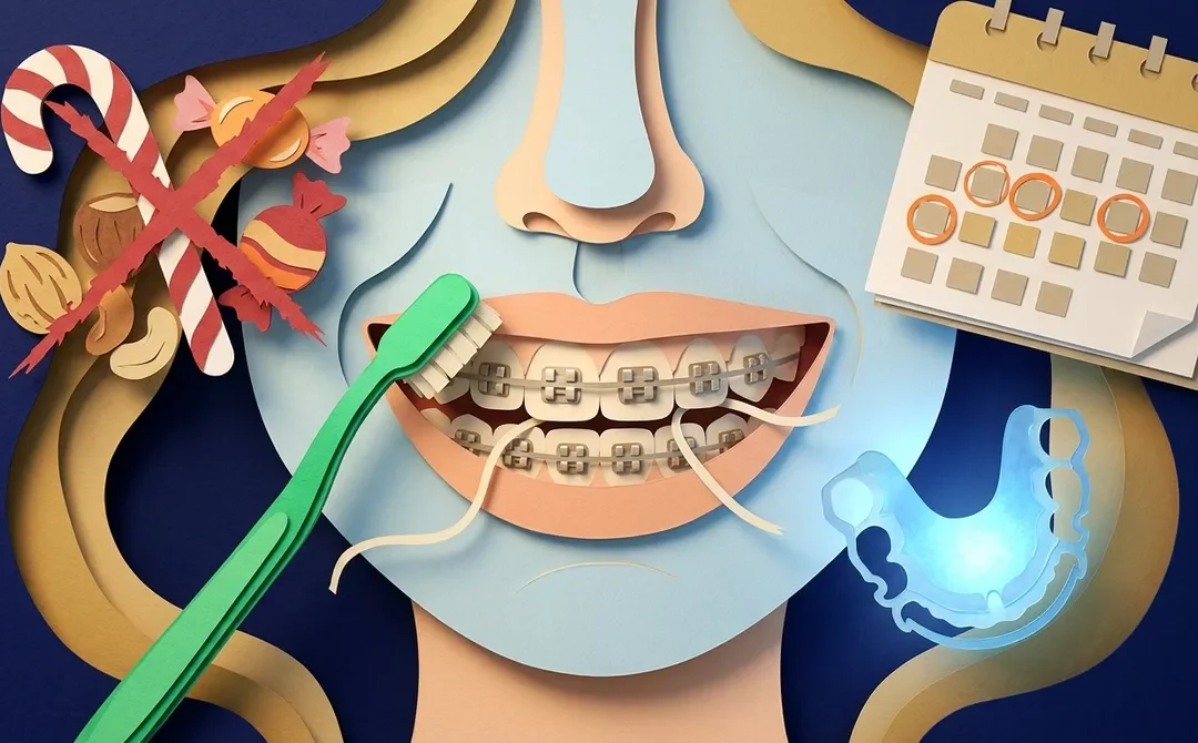 How to Get the Most Out of Your Dental Braces Treatment