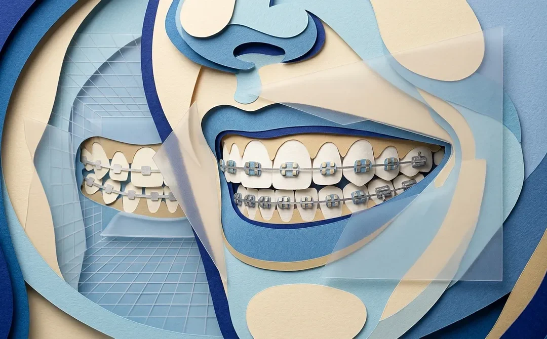 Why Choose a Professional Orthodontist in Clearwater?