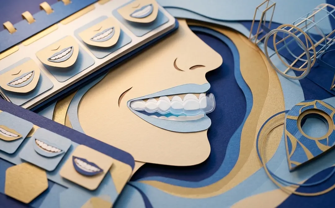 Where Can You Find Invisible Braces Near Me?