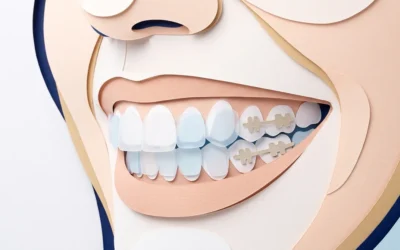 15 Less Visible Braces Options for a More Discreet Smile