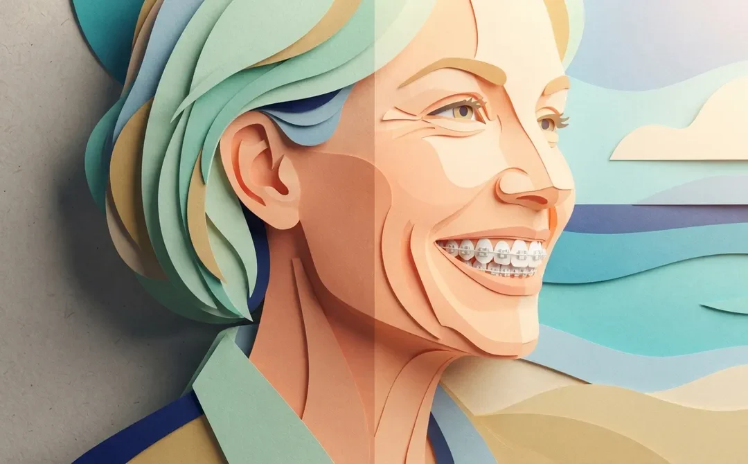 Adult Braces in Clearwater: Your Guide to a New Smile