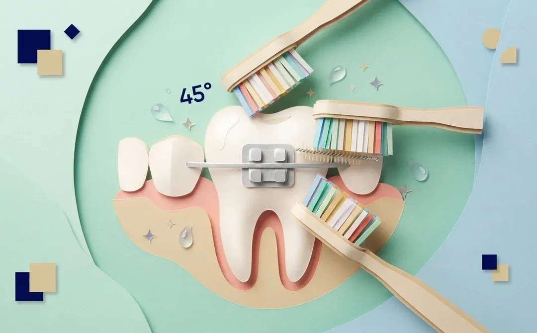 8 Steps to Brush Teeth With Braces the Right Way