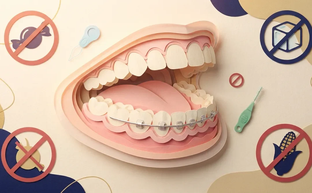 3 Facts About the Wire Behind Teeth After Braces