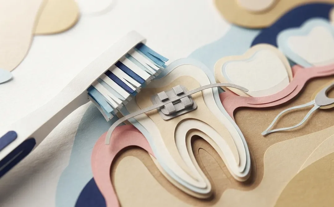 How Do You Toothbrush With Braces the Right Way?