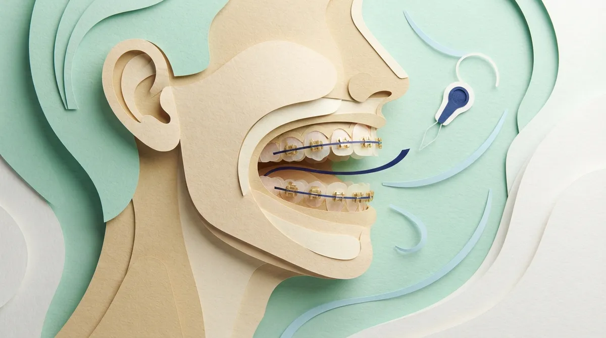 7 Lingual Braces Facts Clearwater Patients Should Know 7 Lingual Braces Facts Clearwater Patients Should Know