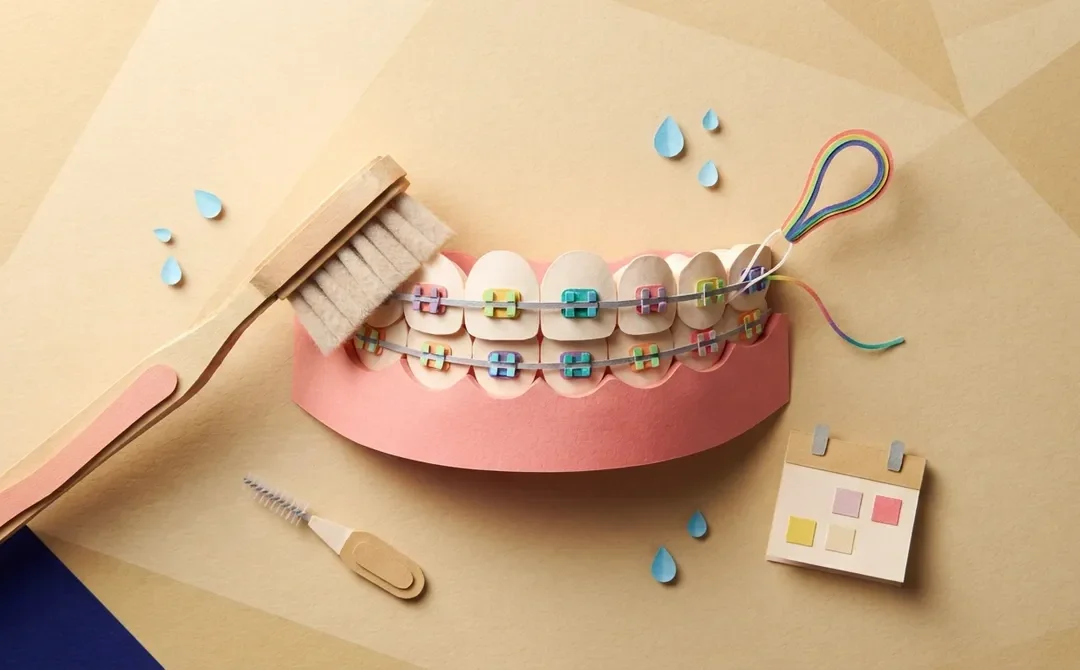 Why Is Brushing Teeth With Braces So Tricky at First?