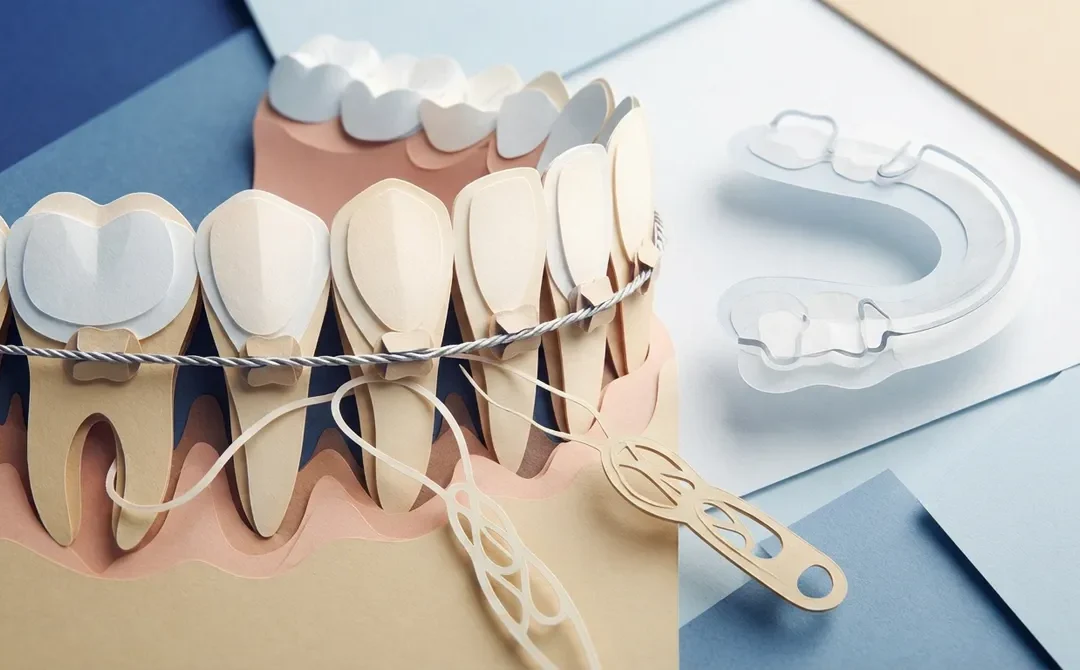 How to Care for a Permanent Retainer After Braces