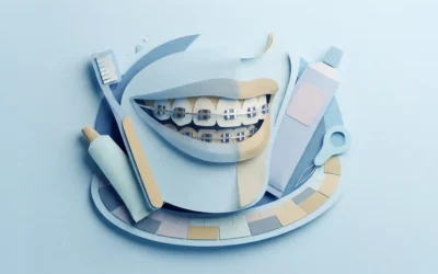 10 Smart Teeth Whitening Braces Tips for 2026