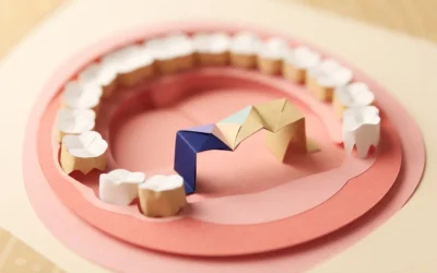 Why Does Early Loss of Baby Teeth Matter for Smiles?