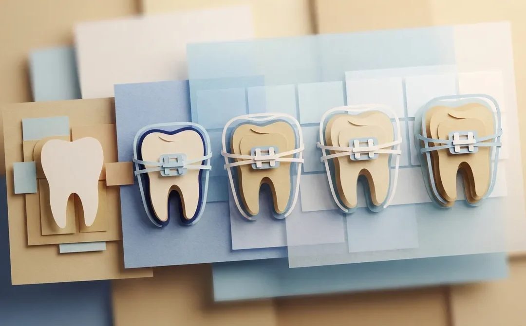 12 Factors That Shape Your Braces Timeline (2026)