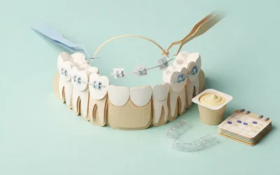 What Happens at the Final Braces Appointment? A Guide