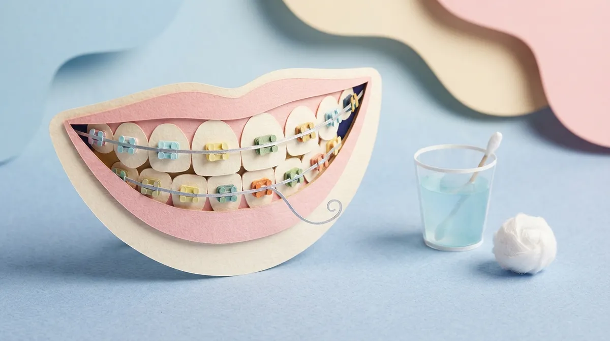 10 Loose Wire Fix Steps for Braces That Really Help 10 Loose Wire Fix Steps for Braces That Really Help